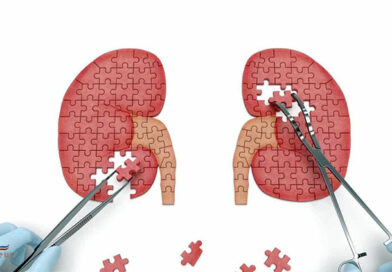 Pedras nos rins podem levar à doença renal crônica?