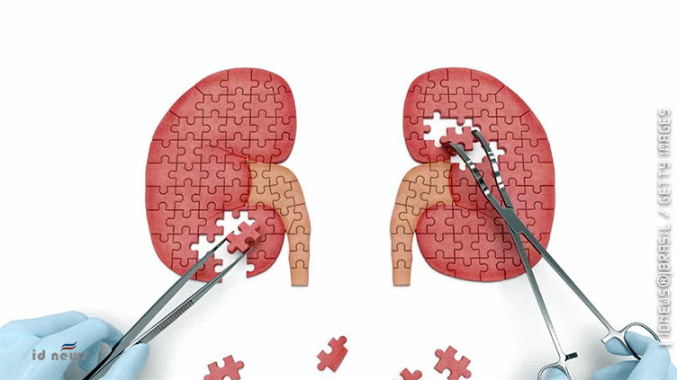 Pedras nos rins podem levar à doença renal crônica?